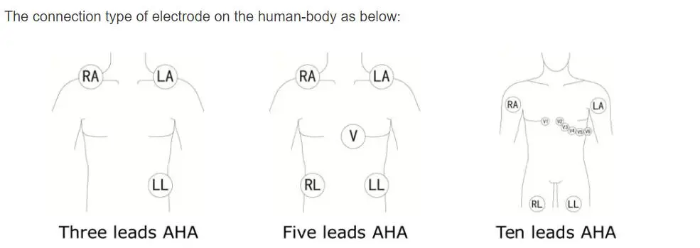 Konpatib Bionet BM3 BM5 yon sèl pyès ECG kab ak leadwires, AHA, 3-plon, menen, wouj 12pin
